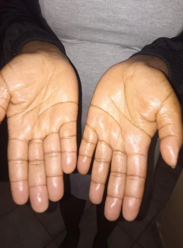 Everlyne alimua kutowasalimu watu kwa mikono kutokana na kwamba mikono yake ilikuwa inatoka jasho jingi