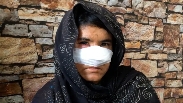 زرکه او ډاکټر احمدزی