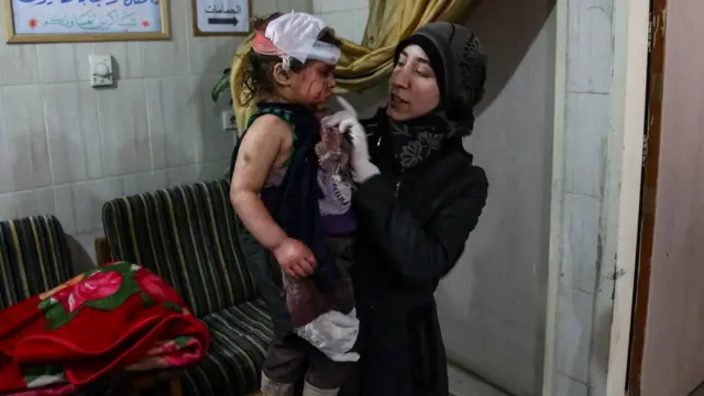 أماني بلور في مشفى "الكهف" في كفربطنا/ غوطة دمشق الشرقية، فبراير/شباط 2018