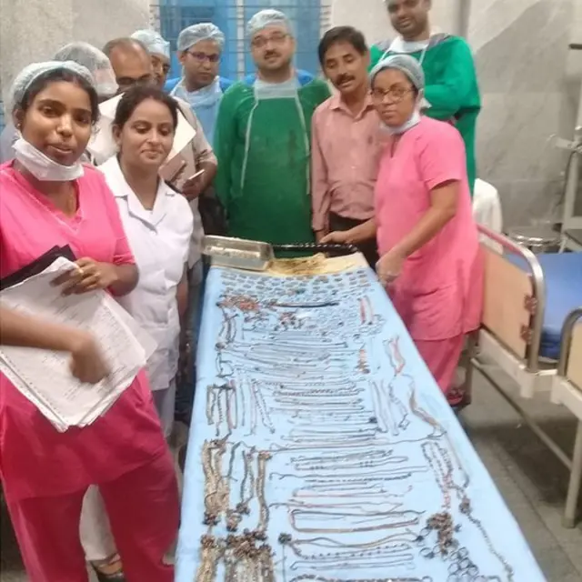 পেট থেকে বের করা অলংকার সহ হাসপাতালের ডাক্তার ও নার্সরা