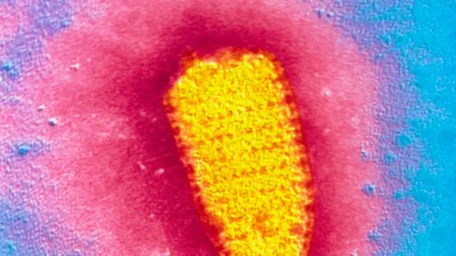 Вирус бешенства