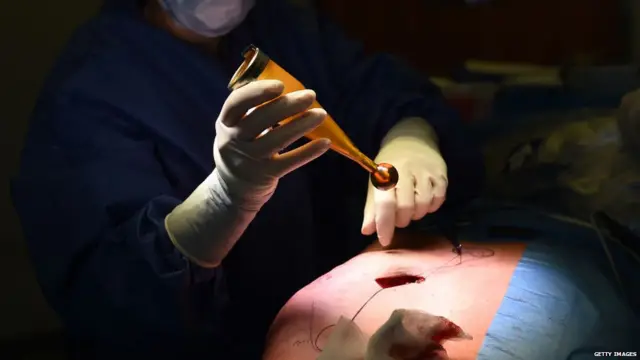 Breast Cancer Surgery