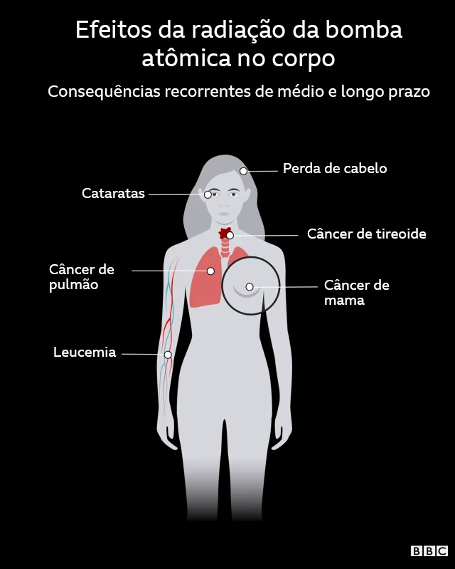 Infográfico