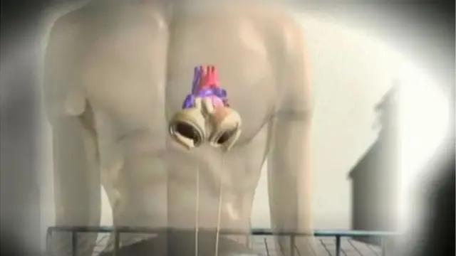 শরীরের ভেতরে থাকা একটি প্লাস্টিকের পাম্প মেশিন রক্ত সঞ্চালন করে শরীরের বিভিন্ন অংশে পাঠিয়ে দেয়