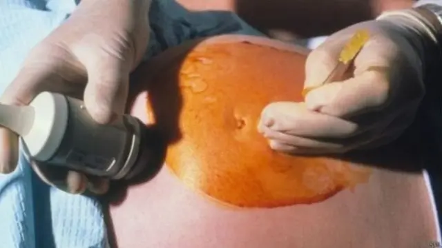 जुळी बाळं