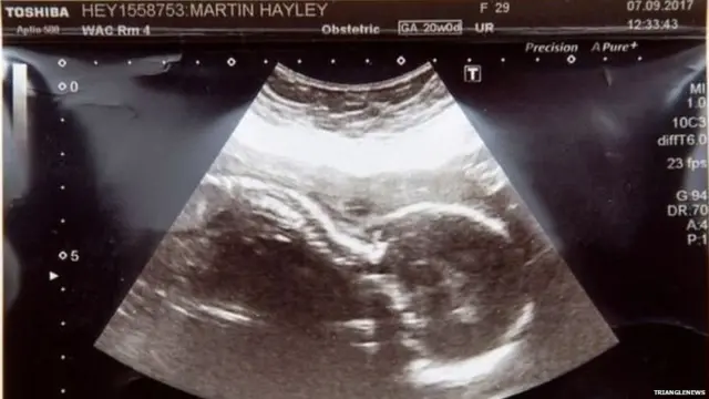 ਹਾਰਲੇ ਮਾਰਟਿਨ ਤੇ ਉਨ੍ਹਾਂ ਦੇ ਪਤੀ ਸਕੌਟ