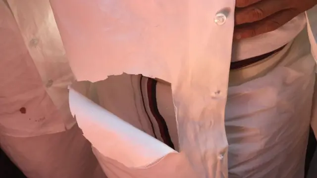 சட்டப்பேரவையில் மு.க.ஸ்டாலின் சட்டை கிழிப்பு (புகைப்படத் தொகுப்பு)