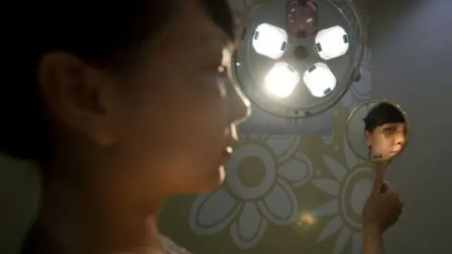 प्लॅस्टिक सर्जरी