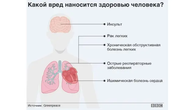 Что необходимо знать о раке гортани