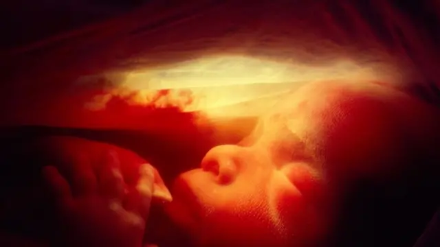 تولد المرأة بكامل مخزون البويضات الذي ستنتجه طيلة حياتها، ويبلغ عددها نحو مليون بويضة