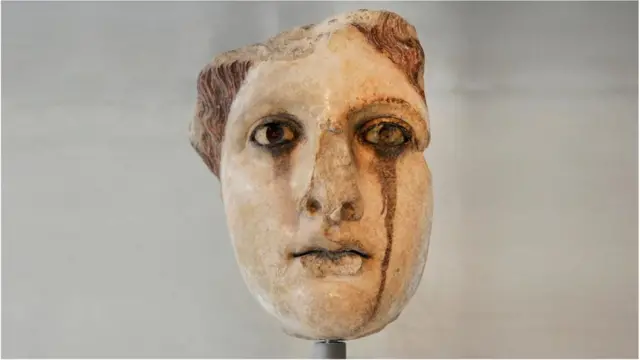 مائگرین، دردِ شقیقہ، آدھے سر کا درد