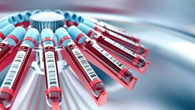 Пробирки с анализами крови в центрифуге
