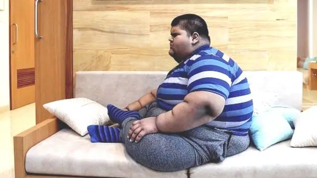 सर्जरी और कई हफ़्तों के इलाज के बाद मिहिर जैन का वज़न 237 किलो से घटकर 165 किलो हो गया था