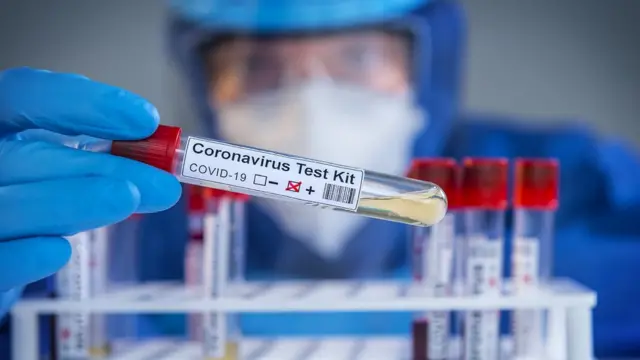 ஏன் கொரோனா வைரசை கட்டுப்படுத்த மேற்கொள்ளப்படும் நடவடிக்கைகள் அனைவருக்கும் உதவாது ?