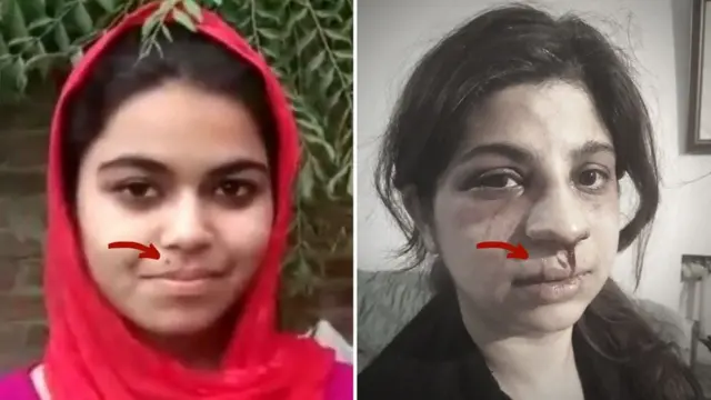 सोशल मीडिया