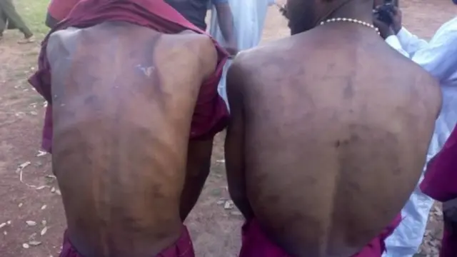 Akẹyinsi àwọn ti wọ́n fi ẹgba dá batani si lara