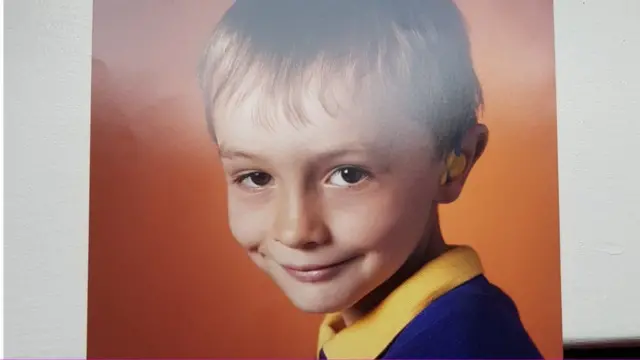 نشانه‌های کم شنوایی ویل موسلی‌ـرابرتز از دوران کودکی او شروع شد