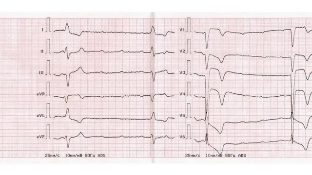 કાર્ડિયોગ્રામ