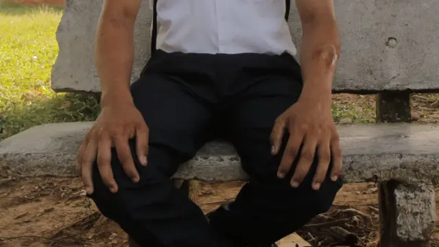 Brazos de Jhon (Foto: Natalio Cosoy/ BBC Mundo)