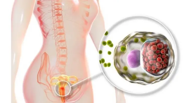 यौन संक्रमण