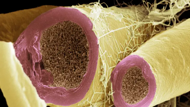 Mielina alrededor de fibras nerviosas