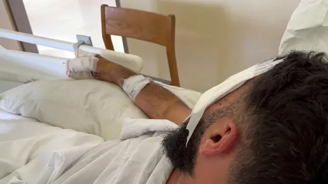 رجب مصاب يستلقي على سرير المستشفى وعينه ويده مصابة.