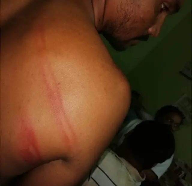 భద్రాద్రి కొత్తగూడెం జిల్లాలో అటవీ అధికారిపై దాడి