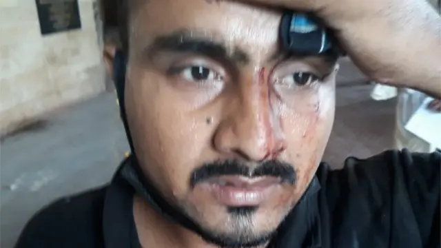 దాడిలో గాయపడిన భద్రతా సిబ్బంది