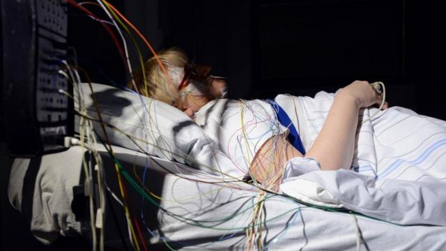 Единственный способ диагностировать апноэ сна - наблюдать за тем, как спит человек