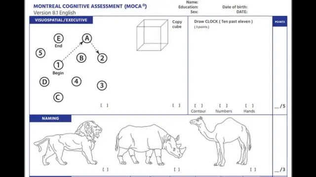 એમઓસીએ ટેસ્ટ