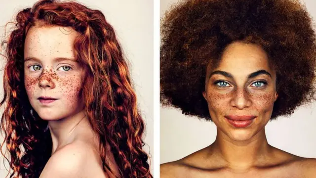 கரும்புள்ளிகள்