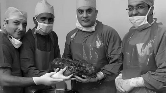 వైద్యులు తొలగించిన మూత్ర పిండం ఇదే