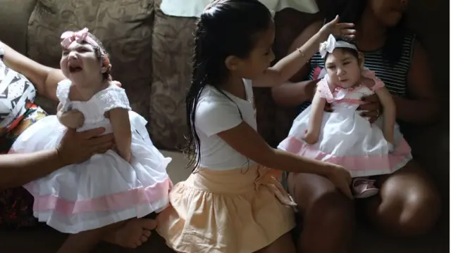 জিকার কারণে ২০১৫ ও ১৬ সালের দিকে ব্রাজিলে চার হাজারের মতো শিশু মাইক্রোসেফালি নিয়ে জন্মেছে।