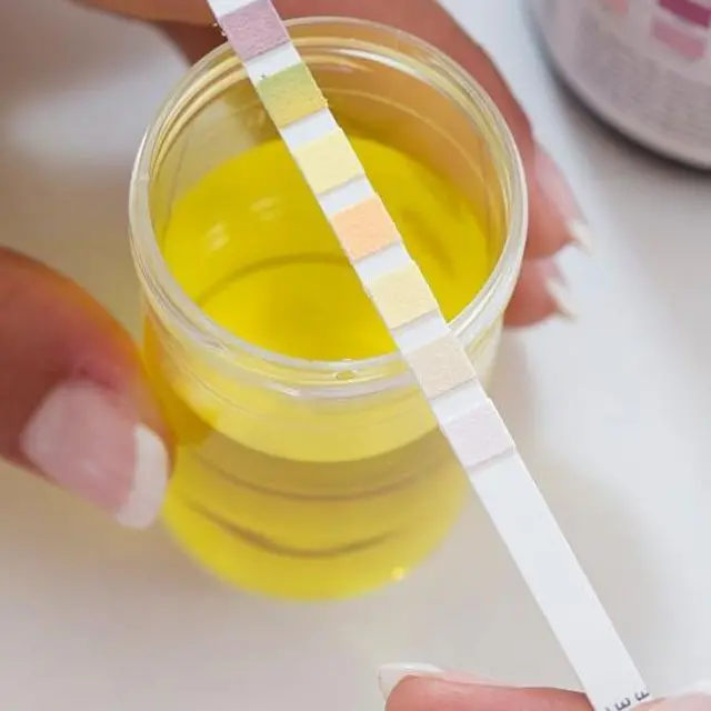 प्रतीकात्मक तस्वीर.