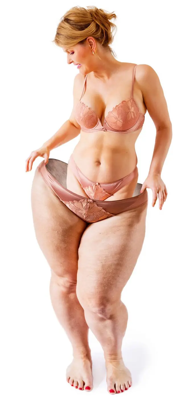 Mujer delgada metida en su figura gorda