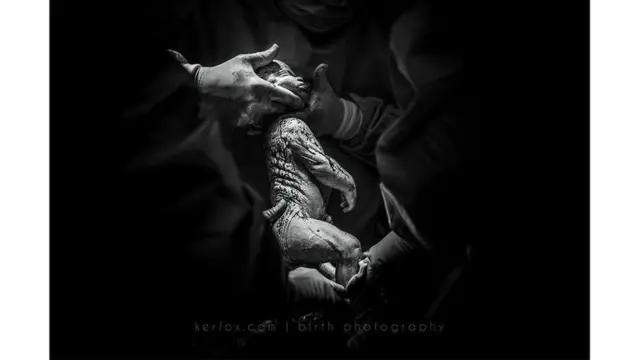 Mención especial: "17 años esperando: un milagro de "no-fertilidad", de Ker-Fox Photography