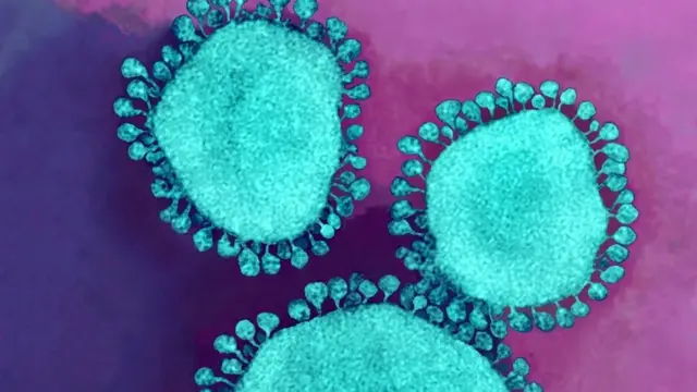 Coronavirus particles. Coloured transmission electron micrograph (TEM) of three coronavirus particles.