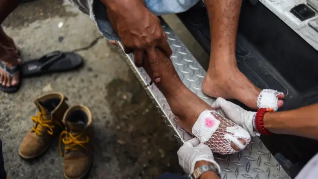 Pie ampollado de un participante de la caravana de migrantes