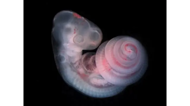 Зародыш африканской домовой змеи в яйце, отложенном сутки назад.