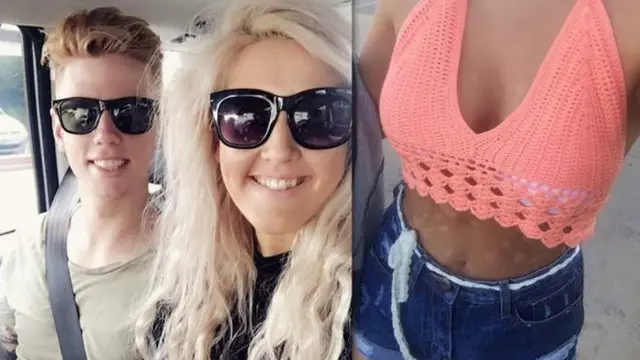 Bryony con su novio y las marcas en su estómago que ambos "adoran" (Foto: Bryony Bateman)