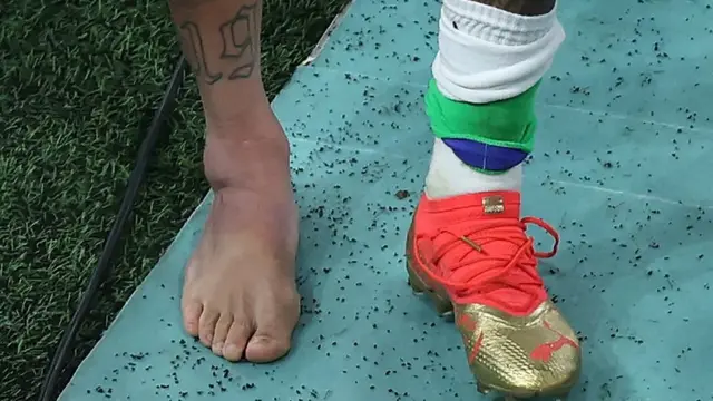 Neymar removed his footwear to display a heavily swollen ankle after being substituted near the end of Brazil's win over Serbia