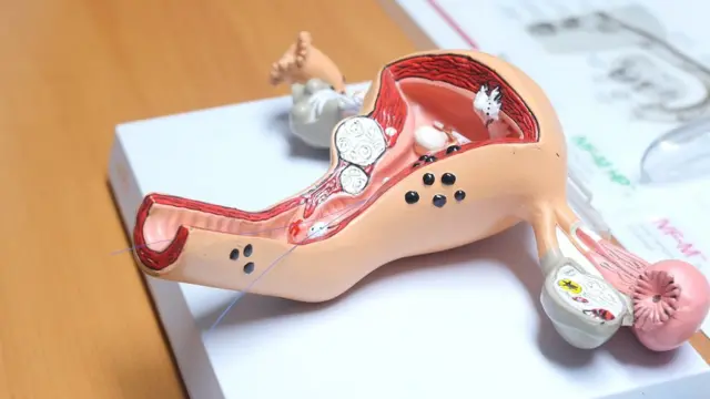 (캡션) 재생산활동은 여성 건강에 큰 영향을 미친다