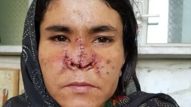 Zaarkaa ohospitaala osoo jirtuu