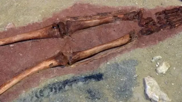 Les archéologues ont noté que les jambes étaient plus courtes que la normale pour un garçon de son âge.