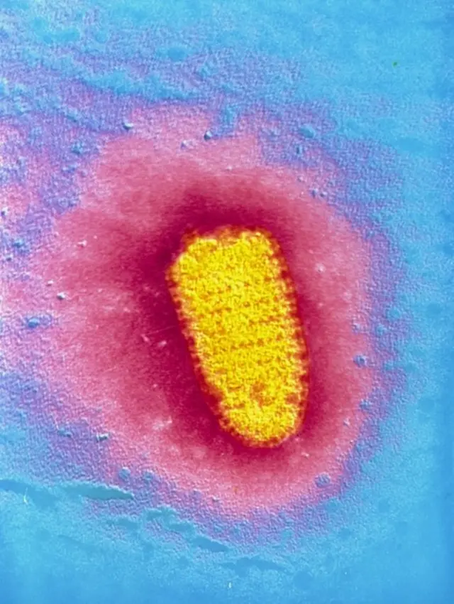 रेबिज भाइरस