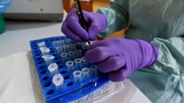 Oṣiṣẹ ilera n ṣe ayẹwo nkan