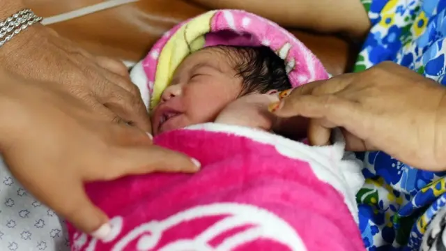 சிசரியன் வழி குழந்தை