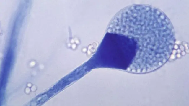 મ્યુકરમાઇકૉસિસ માટે જવાબદાર ફૂગનો ફોટોમાઇક્રૉગ્રાફ