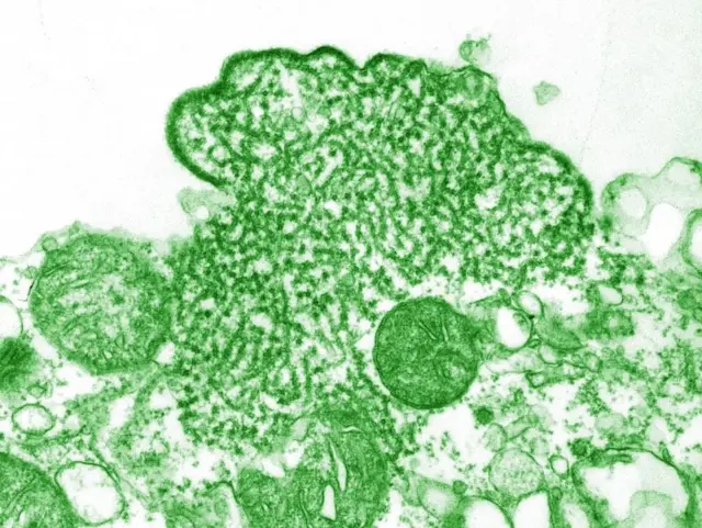 निपा भाइरस