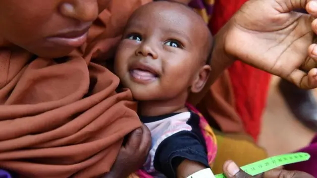 임페리얼 칼리지 런던의 조나단 스완 교수는 영양실조가 아이들 몸의 자연적 방어기제를 손상해 악순환을 만들 수 있다고 설명한다
